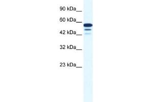 WB Suggested Anti-ZNF230 Antibody Titration:  0.