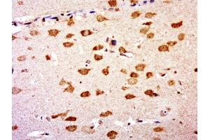 Immunohistochemistry (Paraffin-embedded Sections) (IHC (p)) image for anti-Guanine Nucleotide Binding Protein (G Protein), beta 5 (GNB5) (AA 51-150) antibody (ABIN1714058)