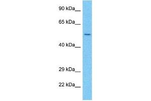 Host:  Rabbit  Target Name:  AVR2A  Sample Type:  Ovary Tumor lysates  Antibody Dilution:  1.