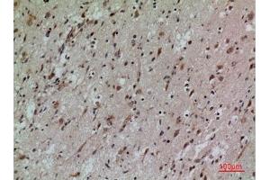 Immunohistochemical analysis of paraffin-embedded human-brain, antibody was diluted at 1:100. (CD58 Antikörper  (Internal Region))