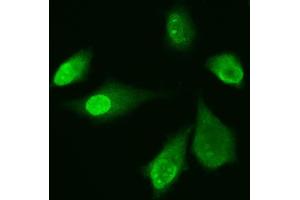 IF analysis of ADK using anti-ADK antibody (ABIN4886430). (ADK Antikörper  (AA 165-351))