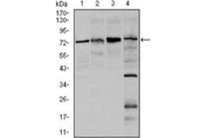 Western Blotting (WB) image for anti-Forkhead Box O1 (FOXO1) antibody (ABIN1107270) (FOXO1 Antikörper)