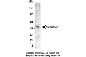 Image no. 1 for anti-Cytochrome P450, Family 19, Subfamily A, Polypeptide 1 (CYP19A1) (C-Term) antibody (ABIN363492)