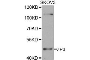 Western blot analysis of extracts of SKOV3 cells, using ZP3 antibody. (Zona Pellucida Glycoprotein 3 Antikörper)
