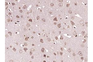 Paraformaldehyde-fixed, paraffin embedded Mouse brain Antigen retrieval by boiling in sodium citrate buffer (pH6. (Caspase 6 Antikörper  (AA 181-293))