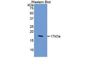 Western blot analysis of the recombinant protein. (Factor VIII Antikörper  (AA 2253-2346))