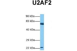 Host:  Rabbit  Target Name:  U2AF2  Sample Tissue:  Human Jurkat  Antibody Dilution:  1. (U2AF2 Antikörper  (N-Term))