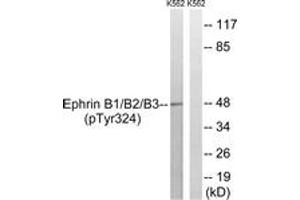Western blot analysis of extracts from K562 cells treated with serum 20% 15', using Ephrin B1/B2/B3 (Phospho-Tyr324) Antibody. (Ephrin B1/B2/B3 (AA 290-339), (pTyr324) Antikörper)