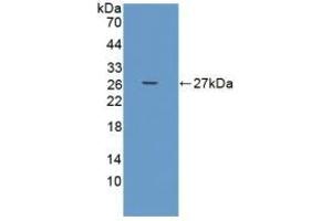 Detection of Recombinant ADAMTS9, Human using Polyclonal Antibody to A Disintegrin And Metalloproteinase With Thrombospondin 9 (ADAMTS9) (ADAMTS9 Antikörper  (AA 1727-1935))