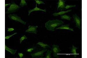 Immunofluorescence of monoclonal antibody to GFRA1 on HeLa cell. (GFRA1 Antikörper  (AA 32-119))