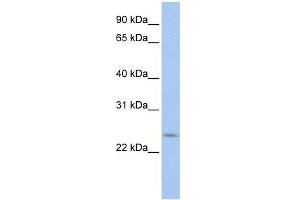 WB Suggested Anti-PRELID2 Antibody Titration: 0.