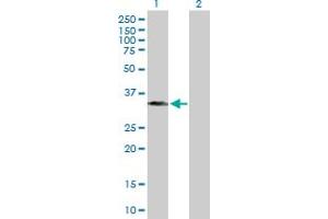 Western Blot analysis of BXDC1 expression in transfected 293T cell line by BXDC1 MaxPab polyclonal antibody. (RPF2 Antikörper  (AA 1-306))