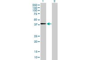 Western Blot analysis of ADAMTSL4 expression in transfected 293T cell line by ADAMTSL4 MaxPab polyclonal antibody. (ADAMTSL4 Antikörper  (AA 1-424))