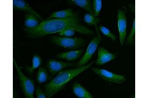 anti-Betaine--Homocysteine S-Methyltransferase (BHMT) (AA 13-386) antibody