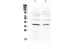 Western blot analysis of MATH1/HATH1 using anti-MATH1/HATH1 antibody . (ATOH1 Antikörper  (N-Term))