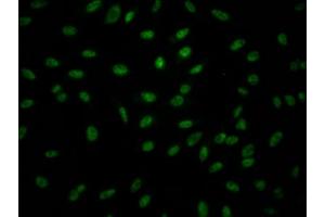 Immunofluorescence staining of Hela Cells with ABIN7127523 at 1:50, counter-stained with DAPI. (Rekombinanter GZMB Antikörper)