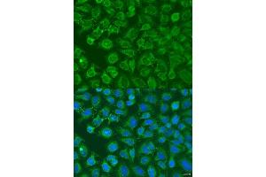 Immunofluorescence analysis of U2OS cells using EIF2B1 antibody (ABIN6132115, ABIN6140035, ABIN6140036 and ABIN6223878) at dilution of 1:100. (EIF2B1 Antikörper  (AA 1-305))
