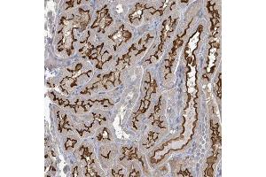 Immunohistochemical staining of human kidney with MDGA1 polyclonal antibody  shows strong membranous positivity in cells in tubules. (MDGA1 Antikörper)