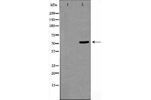 Western blot analysis of extracts from HeLa cells using CELF-1 antibody. (CELF1 Antikörper  (N-Term))