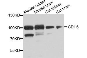 Western blot analysis of extracts of various cell lines, using CDH6 antibody (ABIN5974784) at 1/1000 dilution. (CDH6 Antikörper)