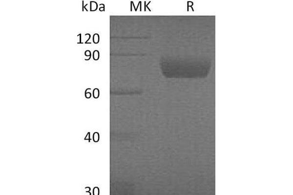 SERPIND1 Protein (His tag)