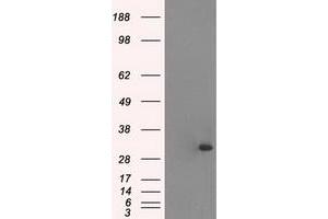 Western Blotting (WB) image for anti-Cardiac Troponin I (TNNI3) (AA 1-210) antibody (ABIN1490609) (TNNI3 Antikörper  (AA 1-210))