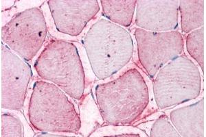 Human Skeletal Muscle: Formalin-Fixed, Paraffin-Embedded (FFPE) (SEMA4B Antikörper  (Internal Region))