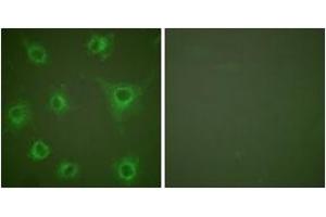 Immunofluorescence analysis of COS7 cells, using Collagen II Antibody.
