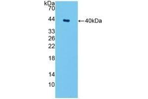 SPTLC1 Antikörper  (AA 143-473)