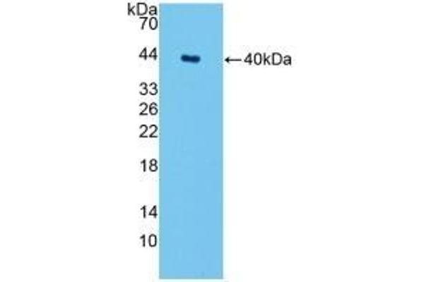 SPTLC1 Antikörper  (AA 143-473)