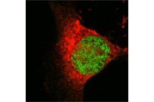 Confocal immunofluorescence analysis of Eca 109 cells using MOF/MYST1 mouse mAb (green), showing nuclear localization. (MYST1 Antikörper)