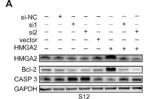 Expression of HMGA2 and its related genes in S12, SiHa, and CaSki cellsWestern blot analysis of HMGA2, Bcl-2, and Caspase 3 protein expression in S12 (A), SiHa (B), and CaSki (C) cells and control cells after treatment with HMGA2 overexpression plasmid or siRNAs. (Caspase 3 Antikörper  (AA 55-160))
