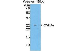 Western blot analysis of the recombinant protein. (Cathepsin K Antikörper  (AA 116-329))