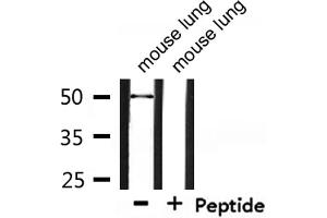 Western blot analysis of extracts from mouse lung, using Retinoic Acid Receptor beta Antibody. (Retinoic Acid Receptor beta Antikörper  (Internal Region))