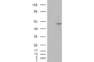 Western Blotting (WB) image for anti-V-Set Domain Containing T Cell Activation Inhibitor 1 (VTCN1) (Internal Region) antibody (ABIN2466446) (VTCN1 Antikörper  (Internal Region))