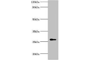Western blot All lanes: N-alpha-acetyltransferase 10 antibody at 5 μg/mL + Hela whole cell lysate Secondary Goat polyclonal to rabbit IgG at 1/10000 dilution Predicted band size: 27, 25 kDa Observed band size: 27 kDa (PTPDC1 Antikörper  (AA 161-235))