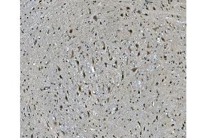 IHC analysis of LSM7 using anti-LSM7 antibody (ABIN7598937).