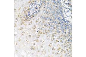 Immunohistochemistry (Paraffin-embedded Sections) (IHC (p)) image for anti-Poly(A) Binding Protein, Cytoplasmic 4 (Inducible Form) (PABPC4) (AA 350-450) antibody (ABIN6145149)