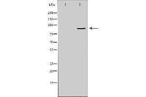 Western blot analysis of Hepg2 whole cell lysates, using TNFAIP3  Antibody. (TNFAIP3 Antikörper  (Internal Region))