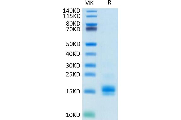 CCL2 Protein (His-Avi Tag,Biotin)