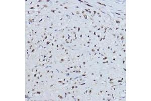 Immunohistochemistry of paraffin-embedded human uterus using ESRRA antibody (ABIN6129375, ABIN6140306, ABIN6140307 and ABIN6218463) at dilution of 1:200 (40x lens). (ESRRA Antikörper  (AA 1-423))