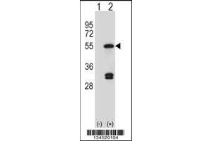 Western blot analysis of FDFT1 using rabbit polyclonal FDFT1 Antibody using 293 cell lysates (2 ug/lane) either nontransfected (Lane 1) or transiently transfected (Lane 2) with the FDFT1 gene. (FDFT1 Antikörper  (C-Term))