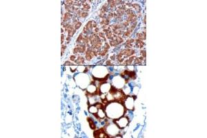 Image no. 2 for anti-Pancreatic and Duodenal Homeobox 1 (PDX1) (C-Term) antibody (ABIN374551) (PDX1 Antikörper  (C-Term))