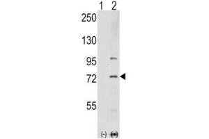 Western blot analysis of PAK1 antibody and 293 cell lysate either nontransfected (Lane 1) or transiently transfected with the PAK1 gene (2). (PAK1 Antikörper  (AA 401-430))