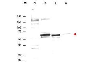 Western Blot of Rabbit Anti-AKT Antibody. (AKT1 Antikörper  (Internal Region))
