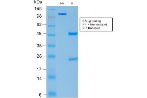 SDS-PAGE Analysis Purified ACTH Rabbit Recombinant Monoclonal Antibody (CLIP/2040R). (Rekombinanter POMC Antikörper  (AA 1-24))