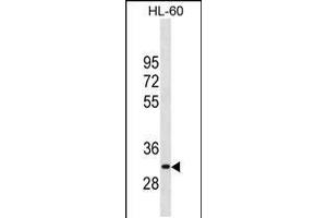 Western blot analysis in HL-60 cell line lysates (35ug/lane). (MMP26 Antikörper  (AA 96-125))
