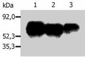 Immunoprecipitation of human PAG1 from the lysate of Raji human Burkitt lymphoma cell line. (PAG1 Antikörper  (C-Term))