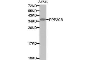 Western blot analysis of extracts of Jurkat cell lines, using PPP2CB antibody. (PPP2CB Antikörper  (AA 1-309))