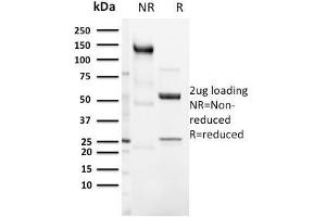 SDS-PAGE Analysis Purified CD3e Rabbit Recombinant Monoclonal Antibody (C3e/3125R). (Rekombinanter CD3 epsilon Antikörper  (AA 23-119))